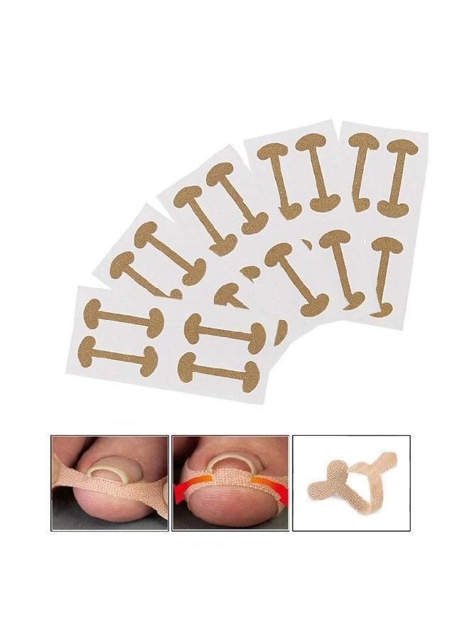 Peachjoy 20 PCS Ingrown Toenail Correction Stickers, Glue-free Ingrown Toenail Corrector Strips, Painless Pedicure Toenail Corrector Patch Professional Toenail Treatment Tool Foot Care - Image 1